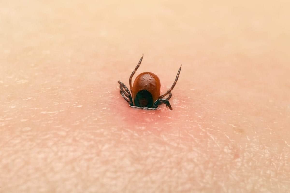 tick bite - Pointe Pest Control | Chicago Pest Control and Exterminator