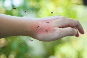 shutterstock 1743391283 Mosquitoes,Bite,On,Adult,Hand,Made,Skin,Rash,And,Allergy